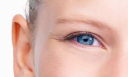 Augenfältchen Botox Hyaluronsäure